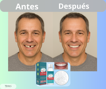 Denta Repair - Renueva tu Sonrisa en 3 simples pasos 👄